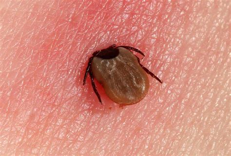 Lyme Disease Remains Top Vector Borne Trouble In The US Pro Health