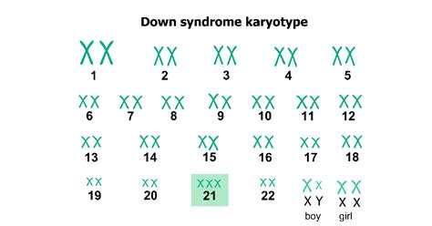 Test Sindrom Down Ce Este I C Nd L Facem Personal Genetics