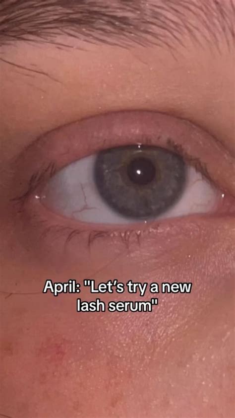 Before and after lash serum