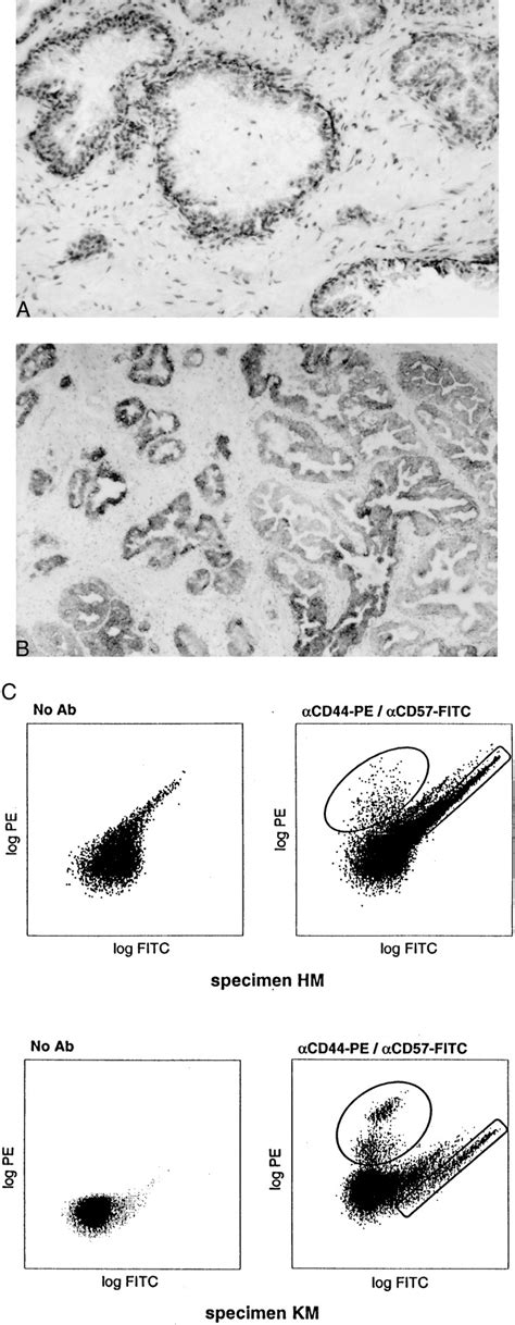 Cellcell Interaction In Prostate Gene Regulation And