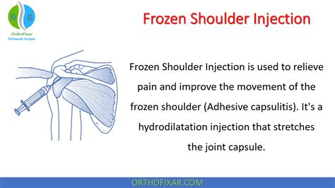 Orthopedic Procedures