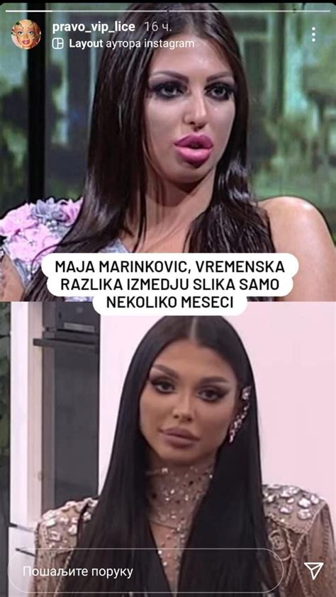 Ovako Je Maja Marinković Izgledala Pre Svih Operacija 🧐 Taki Za Njen Izgled Dao Oko 30 000 Evra