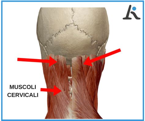 Dolore Alla Nuca Come Risolvere Un Mal Di Testa Cervicale