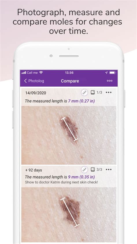 Miiskin Skin Tracker eHealth для iPhone Скачать