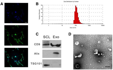 Characterizations Of Schwann Cell Derived Exosomes Characterization Of