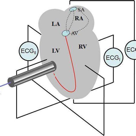 Schematic illustration of the heart, left atrium (LA), right atrium ...