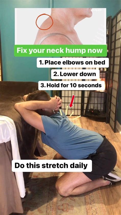 Moore Wellness On Instagram Fix Your Neck Hump Now Do This Stretch