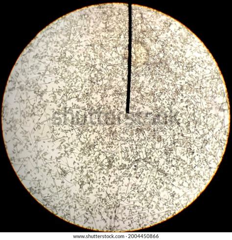 Spores Curvularia Shown By Microscopy Stock Photo 2004450866 | Shutterstock