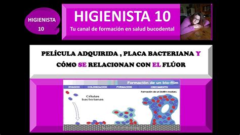 PELÍCULA ADQUIRIDA DENTAL PLACA BACTERIANA Y CÓMO SE RELACIONAN CON EL