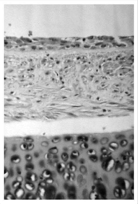 Histologic Findings Of Cryopreserved Tracheal Xenograft Days After