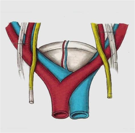 Hypogastric Ablation, Neurolysis for Pelvic Pain | Interventional Pain ...