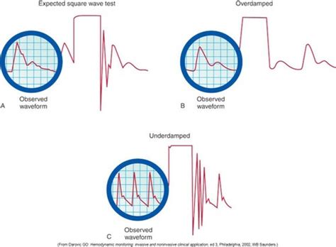 Critical Care Hemodynamics Flashcards Quizlet