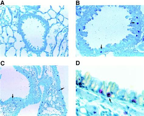 Histologic Staining For Mast Cells Toluidine Blue Staining Of Sections