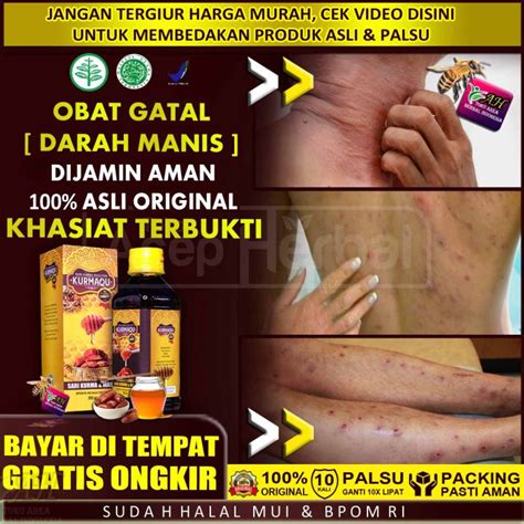 Obat Gatal Gatal Karena Darah Manis Diabetes Melitus Obat Darah