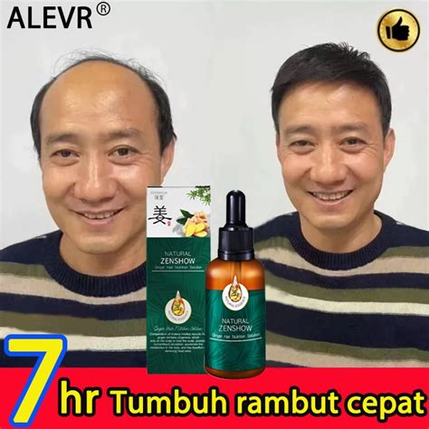 Jual PROMO TERMURAH PENUMBUH RAMBUT Cairan Essence Penumbuh Rambut Anti