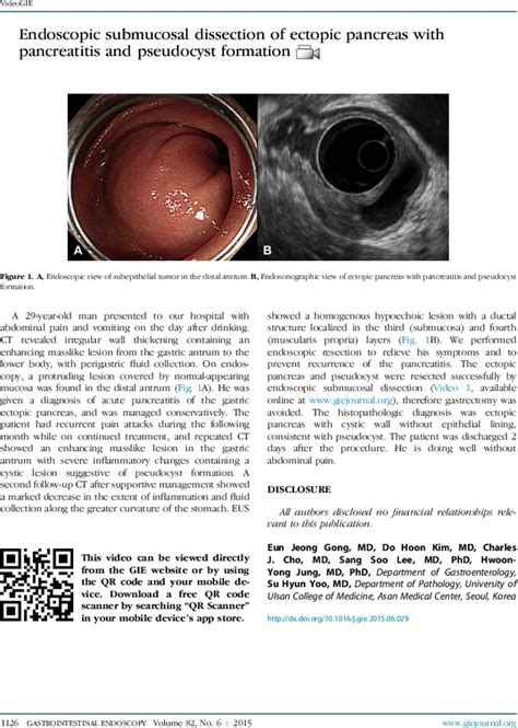 Endoscopic Submucosal Dissection Of Ectopic Pancreas With Pancreatitis