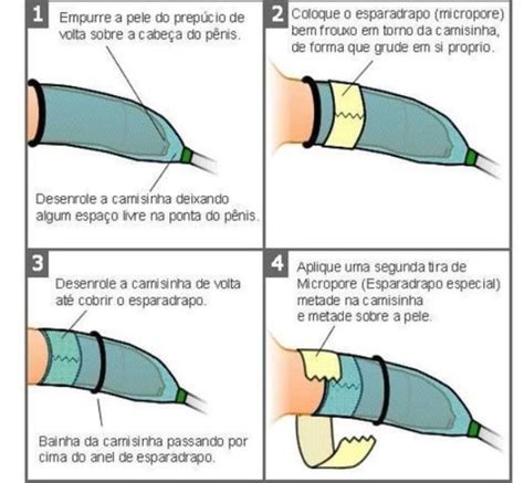 Uripen Nº 6 Dispositivo Para Incontinência Urinária Biomed