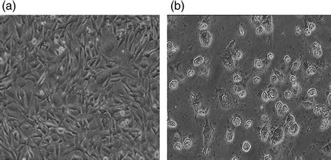 Arsenite Induced Morphological Deformities In HeLa Cell Lines A