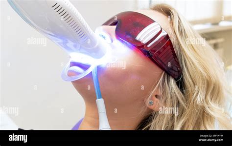 Photopolymer Filling Hi Res Stock Photography And Images Alamy