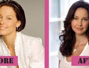 Ashley Judd before and after Plastic Surgery (29) | Celebrity plastic ...