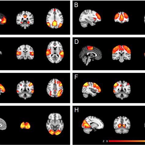 Resting State Networks Rsns Identified As Anatomically And