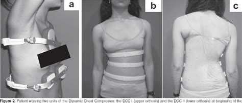 Figure From The Spine Lateral Bending And The Dynamic Chest