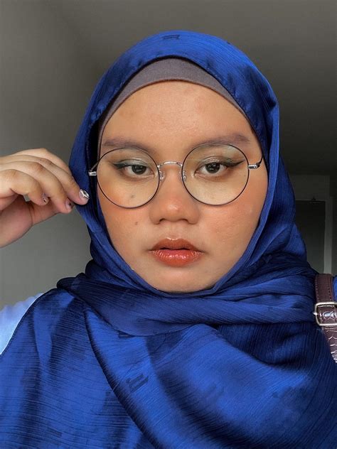 It’s me again 😄. Right eye vs left eye in natural bright light. Crazy