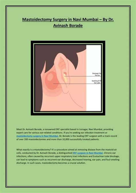 PPT - Mastoidectomy Surgery in Navi Mumbai PowerPoint Presentation ...