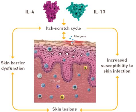 DUPIXENT® (dupilumab) Mechanism of Action for Uncontrolled Moderate-to ...