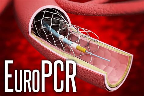 Satisfactory Progress Reports For MitraClip Alternatives MedPage Today