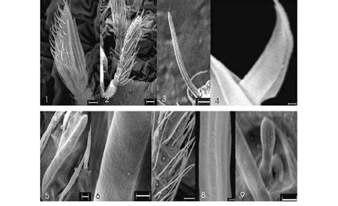 Sem Micrographs Of Antennae Of Male And Female T Chilonis 1 Antenna Download Scientific