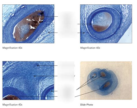 UMBILICAL CORD HISTOLOGY Diagram | Quizlet