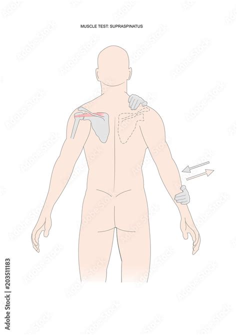 ภาพประกอบสต็อก muscle testing:supraspinatus. Test used in kinesiology, neurology, physical ...