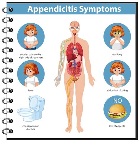 Infograf A De Informaci N De S Ntomas De Apendicitis Vector Gratis