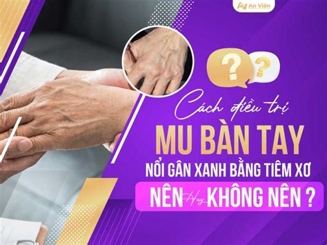 Cách điều trị nổi gân mu bàn tay tiêm xơ 5 ưu điểm tốt nhất