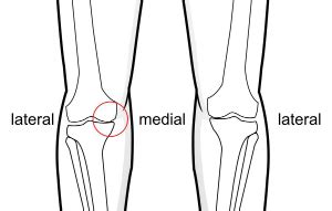 Medial Joint Line