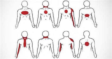 Ces 6 Symptômes Permettent De Reconnaître Une Crise Cardiaque Un Mois Avant Quelle Ne Survienne