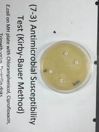 Antimicrobial Susceptibility Test Disk Diffusion Kirby Bauer Method