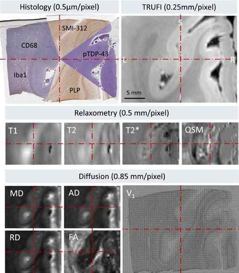 Tensor Image Registration Library Deformable Registration Of Stand