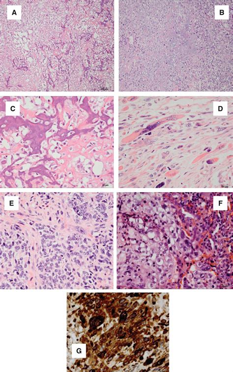 Emca Derived From Emca Stem Cells Ecsc A B Osteosarcomas C D