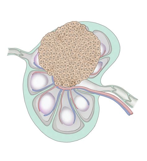 Radiologic Extranodal Extension Of Metastatic Lymph Nodes In Patients