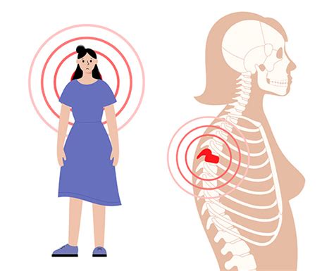 Hunchback in the elderly - Happiest Health