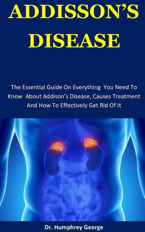 Buy Addison S Disease The Essential Guide On Everything You Need To Know About Addison’s