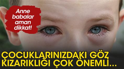 Çocuklarda göz kızarıklığına dikkat