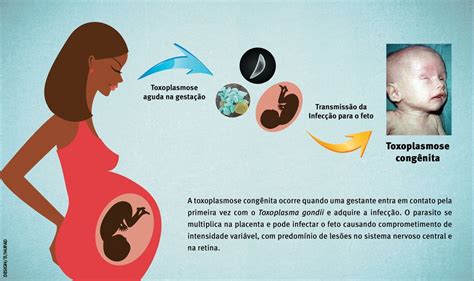 Resumo Toxoplasmose Na Gesta O Colunistas Sanarmed