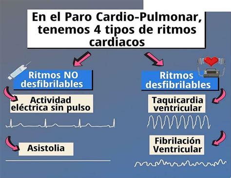 Tipos De Ritmos Cardiacos En El Paro Cardio Pulmonar Fraii UDocz