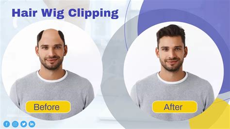 Hair Wig Clipping Hair Wig In Patna What Is Patch Hair Loss