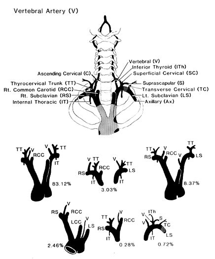 Anatomy Of Vertebral Artery