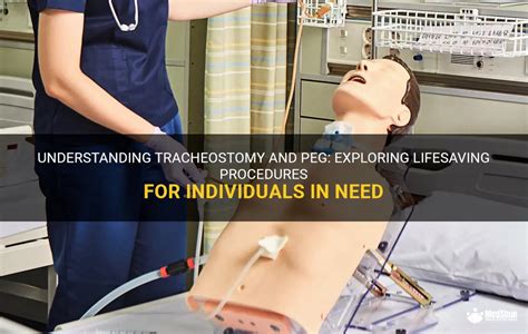 Understanding Tracheostomy And Peg Exploring Lifesaving Procedures For