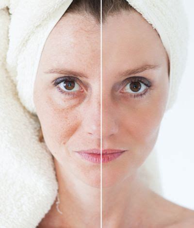 skin rejuvenation dr chaitali mondal